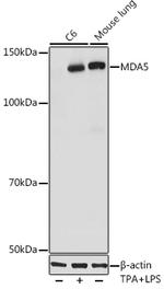 MDA5 Recombinant Rabbit Monoclonal Antibody (2N8Z5)