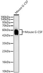 G-CSF Recombinant Rabbit Monoclonal Antibody (3Q1T5)