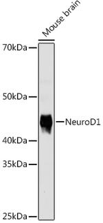 NeuroD1 Recombinant Rabbit Monoclonal Antibody (5V4L8)