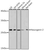 Neurogenin 2 Recombinant Rabbit Monoclonal Antibody (8F2Q8)