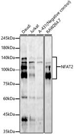 NFATC1 Recombinant Rabbit Monoclonal Antibody (5D4K1)