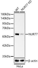 NR4A1 Recombinant Rabbit Monoclonal Antibody (9M2V6)