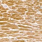 CD273 (B7-DC) Antibody in Immunohistochemistry (Paraffin) (IHC (P))