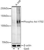 Phospho-Axl (Tyr702) Antibody in Western Blot (WB)