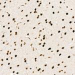Phospho-Chk2 (Thr68) Antibody in Immunohistochemistry (Paraffin) (IHC (P))