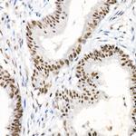 Phospho-Chk2 (Thr68) Recombinant Rabbit Monoclonal Antibody (7R1S5)