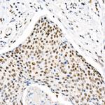Phospho-Chk2 (Thr68) Antibody in Immunohistochemistry (Paraffin) (IHC (P))