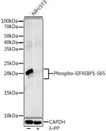 Phospho-4EBP1 (Ser65) Recombinant Rabbit Monoclonal Antibody (9M4D7)