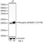 Phospho-4EBP1 (Thr37, Thr46) Antibody in Western Blot (WB)