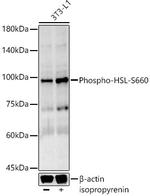 Phospho-HSL (Ser660) Recombinant Rabbit Monoclonal Antibody (2Q8Z3)