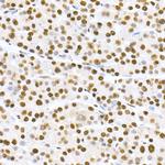 Phospho-MDM2 (Ser166) Antibody in Immunohistochemistry (Paraffin) (IHC (P))