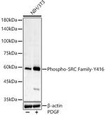 Phospho-SRC (Tyr416) Recombinant Rabbit Monoclonal Antibody (8W3U0)