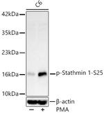 Phospho-Stathmin 1 (Ser25) Antibody in Western Blot (WB)