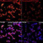Phospho-Zap-70 (Tyr493) Antibody in Immunocytochemistry (ICC/IF)