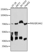 PKR Recombinant Rabbit Monoclonal Antibody (5B7B6)