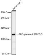PLCG2 Recombinant Rabbit Monoclonal Antibody (0M1U7)