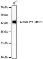 pro MMP9 Recombinant Rabbit Monoclonal Antibody (2N4X3)