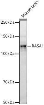 RASA1 Recombinant Rabbit Monoclonal Antibody (6W10G6)