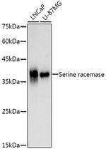 Serine racemase Recombinant Rabbit Monoclonal Antibody (0T6G3)
