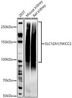 NKCC2 Recombinant Rabbit Monoclonal Antibody (9I0U8)