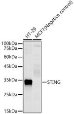 STING Recombinant Rabbit Monoclonal Antibody (7H7A10)