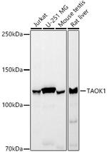 TAOK1 Recombinant Rabbit Monoclonal Antibody (6L4S9)