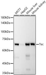 TEC Recombinant Rabbit Monoclonal Antibody (0J6X0)
