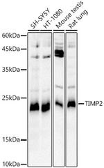 TIMP2 Recombinant Rabbit Monoclonal Antibody (4N9N3)