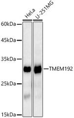 TMEM192 Antibody in Western Blot (WB)