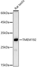 TMEM192 Antibody in Western Blot (WB)