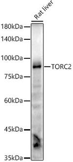 TORC2 Recombinant Rabbit Monoclonal Antibody (7M2V7)
