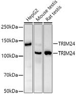 TRIM24 Recombinant Rabbit Monoclonal Antibody (9I0X1)