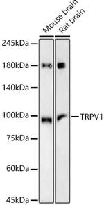 TRPV1 Recombinant Rabbit Monoclonal Antibody (10B2A1)