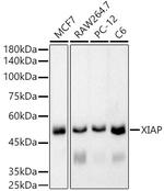 XIAP Recombinant Rabbit Monoclonal Antibody (8T2X5)