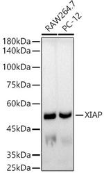 XIAP Recombinant Rabbit Monoclonal Antibody (5S5Q7)