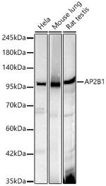 beta-2 Adaptin Recombinant Rabbit Monoclonal Antibody (9W4U6)