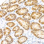 Claudin 18.2 Antibody in Immunohistochemistry (Paraffin) (IHC (P))