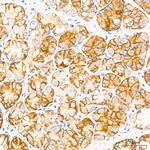 Claudin 18.2 Recombinant Rabbit Monoclonal Antibody (3J4G7)