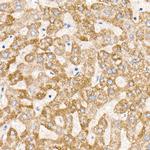MT-ND6 Antibody in Immunohistochemistry (Paraffin) (IHC (P))