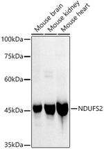 NDUFC2 Recombinant Rabbit Monoclonal Antibody (9W2N4)