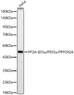 PPP2R2A Recombinant Rabbit Monoclonal Antibody (9E5N2)