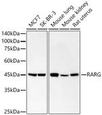 RAR gamma-1,2 Recombinant Rabbit Monoclonal Antibody (9K3Y1)