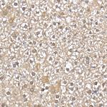UBE2D1 Antibody in Immunohistochemistry (Paraffin) (IHC (P))
