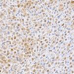 UBE2D1 Antibody in Immunohistochemistry (Paraffin) (IHC (P))