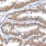 UBE2D1 Recombinant Rabbit Monoclonal Antibody (8E6O0)