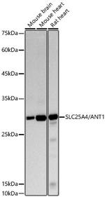 ANT Recombinant Rabbit Monoclonal Antibody (1U7X1)