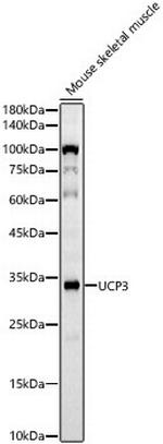 UCP3 Recombinant Rabbit Monoclonal Antibody (10I0J9)