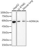 alpha-1a Adrenergic Receptor Recombinant Rabbit Monoclonal Antibody (4G10W8)