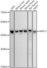 ADSS Recombinant Rabbit Monoclonal Antibody (1P8D9)