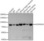 ALDH16A1 Recombinant Rabbit Monoclonal Antibody (7S1P3)